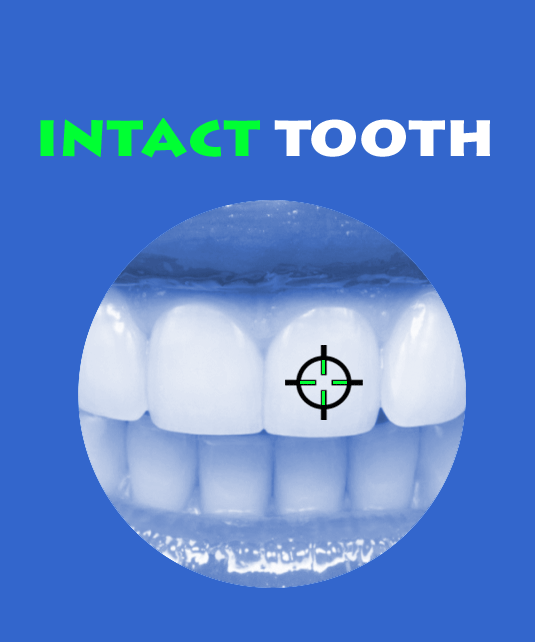 Intact-Tooth